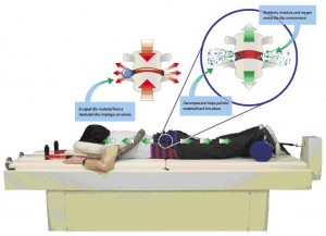 Spinemed1 spinal decompression graphic