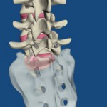 lumbar