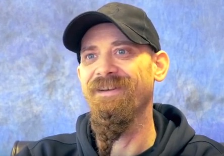 laser fusion testimonial