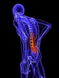 MIS surgery for back pain